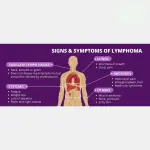 SLL Cancer Explained: Symptoms, Causes, and Treatment Options (2026 Guide)