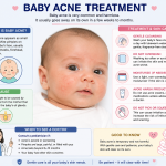 Baby Acne Treatment: Safe and Effective Ways to Clear Infant Acne Fast