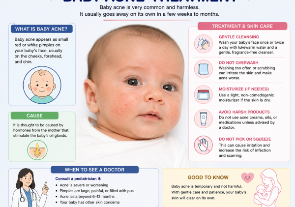 Baby Acne Treatment: Safe and Effective Ways to Clear Infant Acne Fast