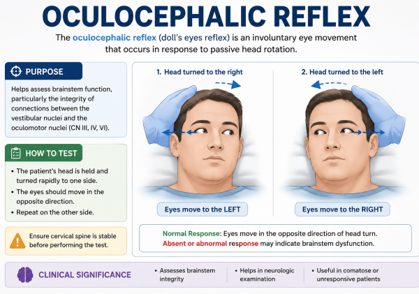 Oculocephalic Reflex (Doll’s Eye Reflex): 7 Key Facts Every Medical Student Should Know