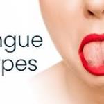 Herpes on Tongue: Symptoms, Causes, Pictures, and Treatment Options