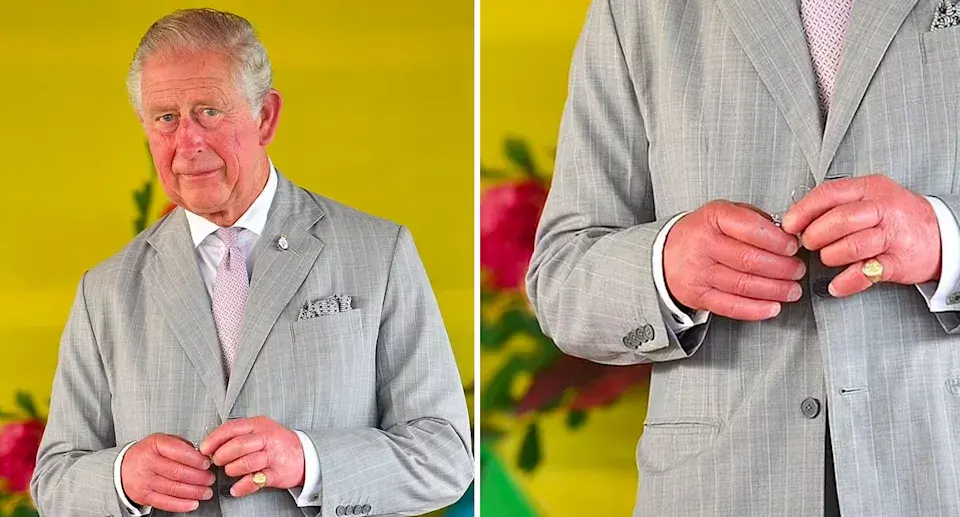 king charles fingers 1