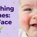 Teething Rash on Face: How to Identify, Treat, and Prevent It