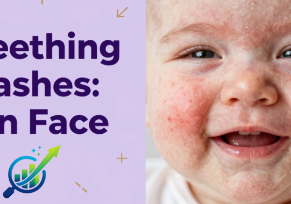 Teething Rash on Face: How to Identify, Treat, and Prevent It